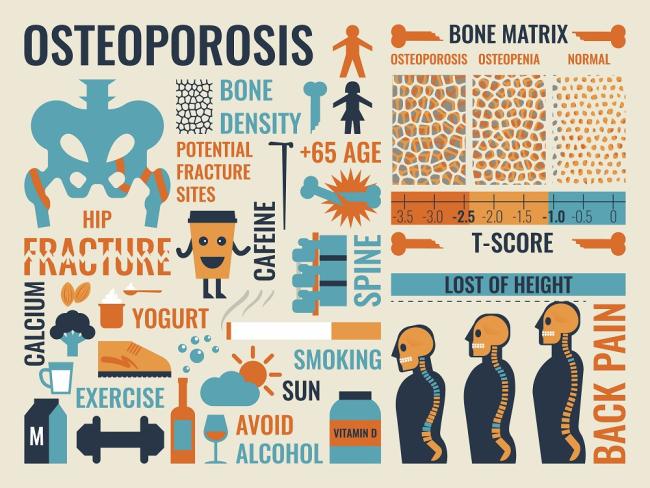 Día Mundial de la Osteoporosis Día Mundial de la Osteoporosis