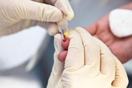 Las farmacias catalanas realizan más de 16.000 pruebas para la detección de la infección por VIH