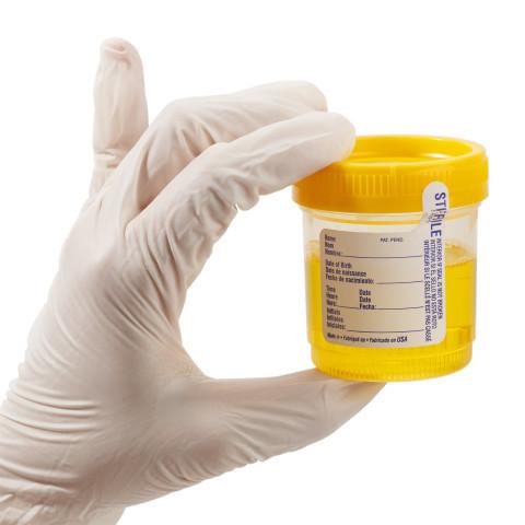 Detección de clamidia Tests para la detección de clamidia en la farmacia