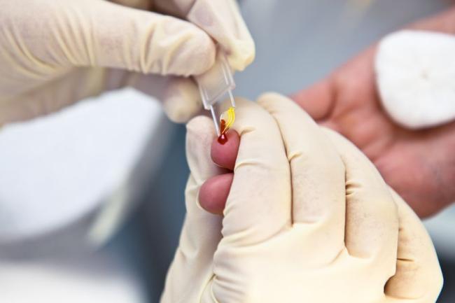 Detección temprada de VIH Las farmacias catalanas realizan más de 16.000 pruebas para la detección de la infección por VIH