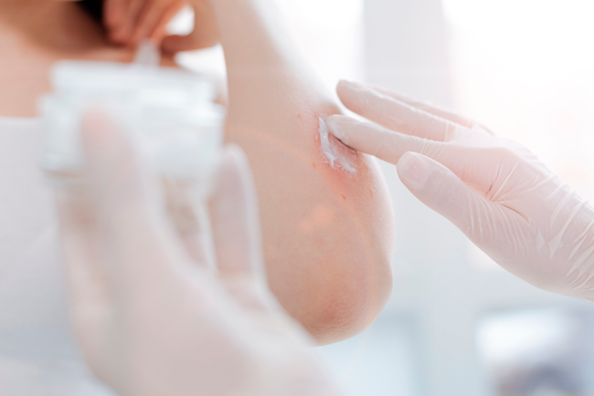¿Qué necesita la piel? La Oficina de Farmacia lo sabe ¿Qué necesita la piel? La Oficina de Farmacia lo sabe