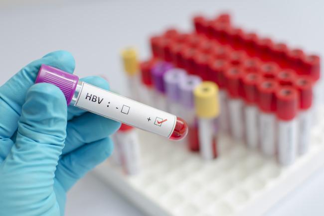 Qué hacer por la hepatitis desde la oficina de farmacia Qué hacer por la hepatitis desde la oficina de farmacia