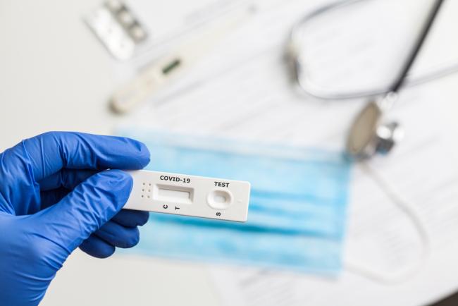 Las farmacias de Ourense realizan test serológicos de la COVID-19 Las farmacias de Ourense realizan test serológicos de la COVID-19