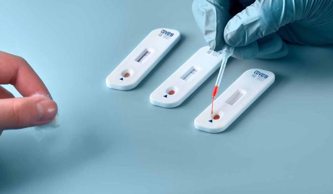 El CGCOF envía a las farmacias una guía para la dispensación de autotest de anticuerpos de la COVID-19 El CGCOF envía a las farmacias una guía para la dispensación de autotest de anticuerpos de la COVID-19