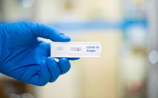 Las oficinas de farmacia podrán dispensar test rápidos de COVID-19 Las oficinas de farmacia podrán dispensar test rápidos de COVID-19