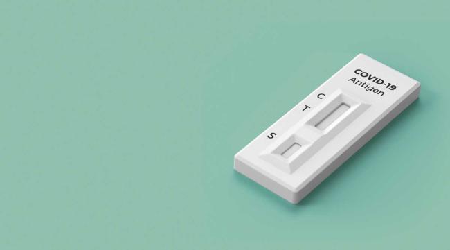 Experiencias con los test de antígenos en la farmacia Experiencias con los test de antígenos en la farmacia
